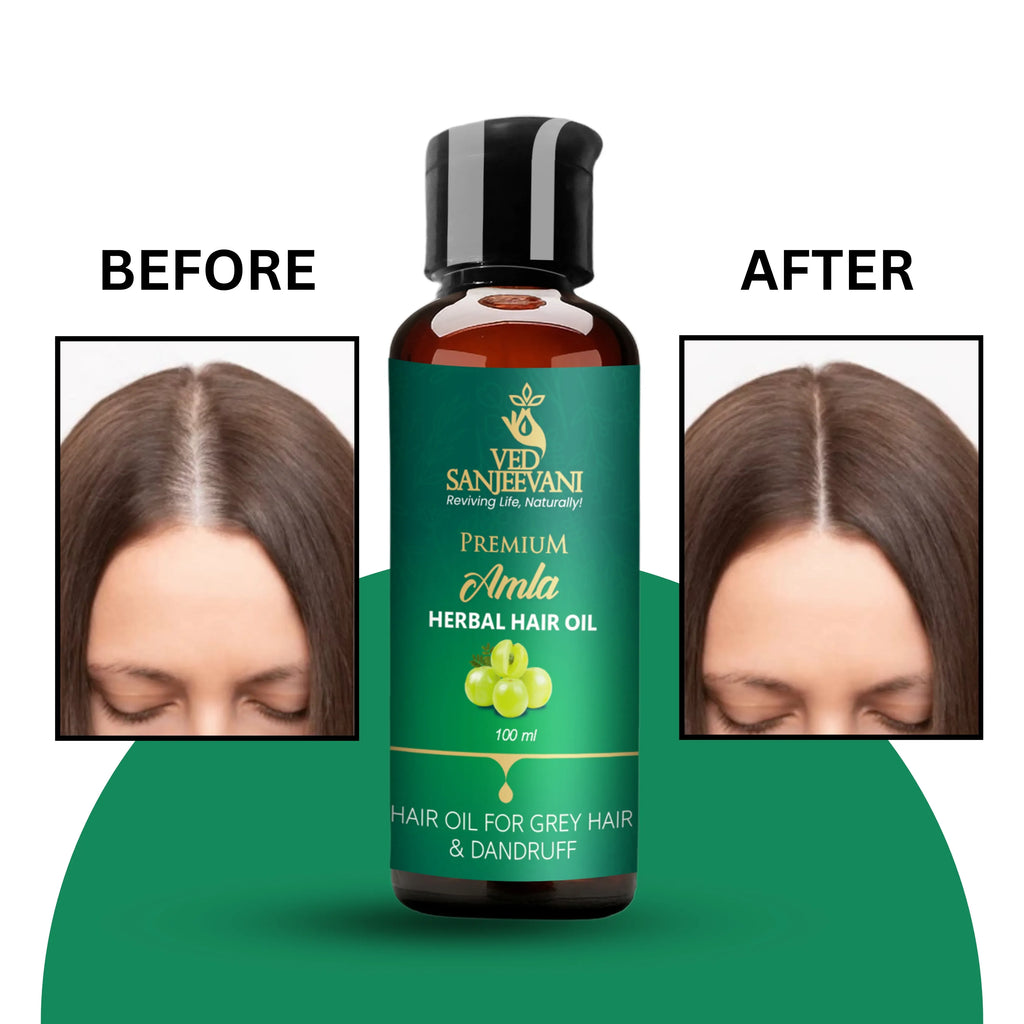 Amla Herbal Hair Oil for Hair Growth & Fall Control