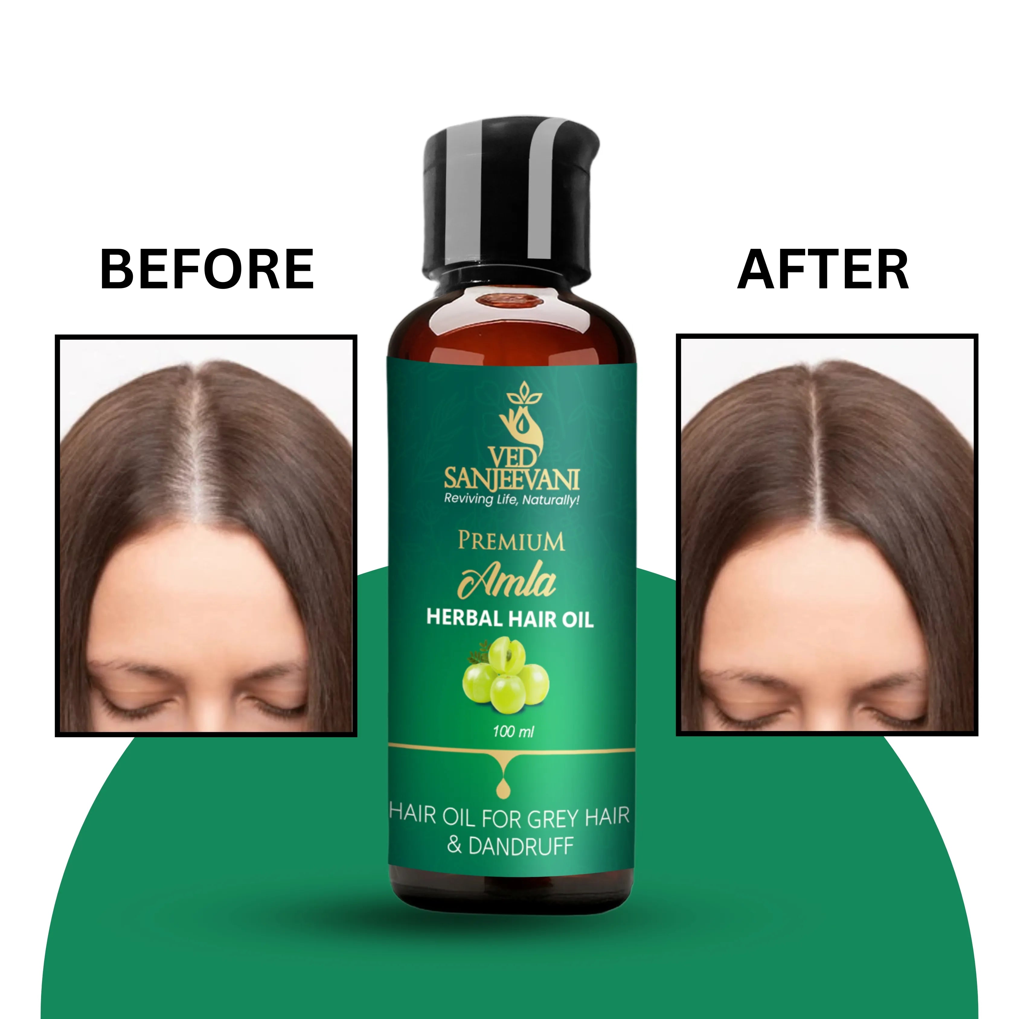 Amla Herbal Hair Oil for Hair Growth & Fall Control